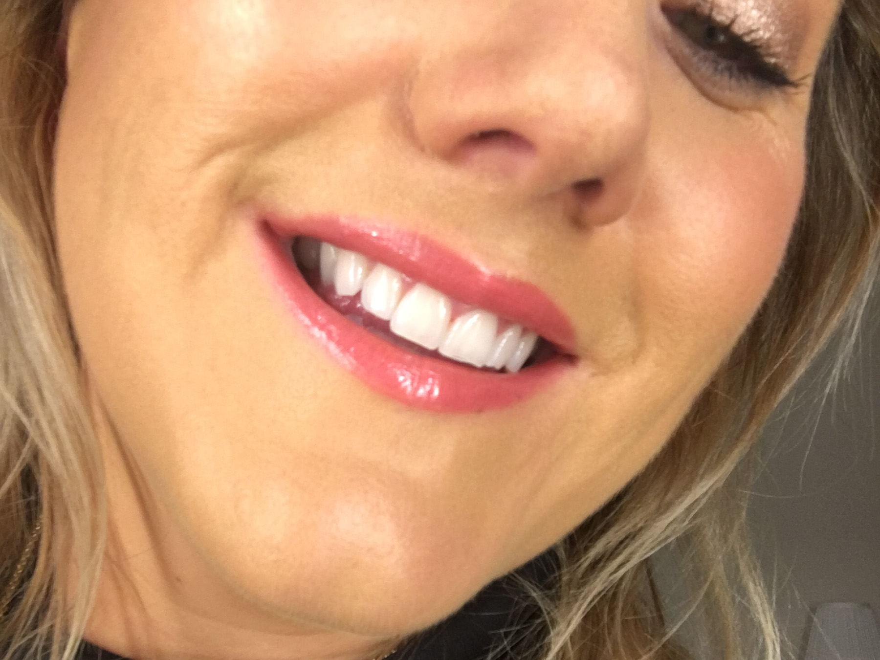 Lipstick-Ysl-RVL-teeth-.jpg